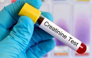 creatinine-test