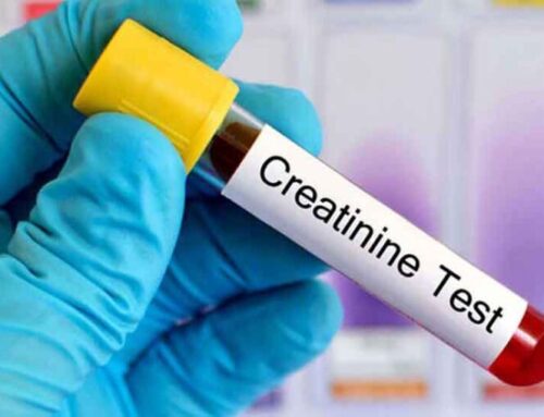 Creatinine – How Nutrition affects it